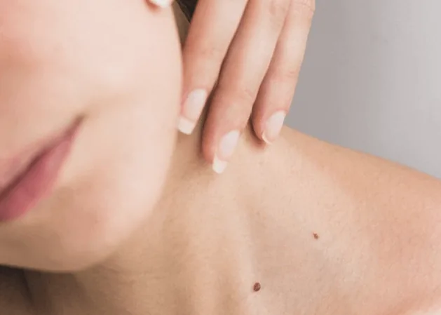 Dermatologie