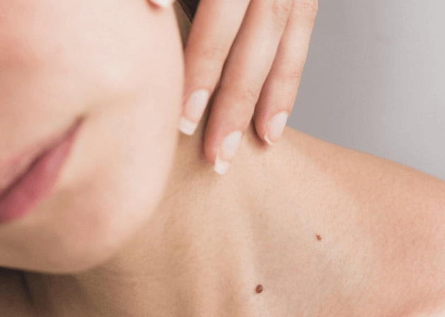 Dermatologie